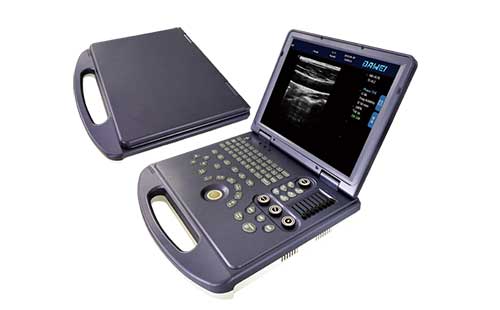 便攜式超聲助力新冠肺炎的監(jiān)測(cè)